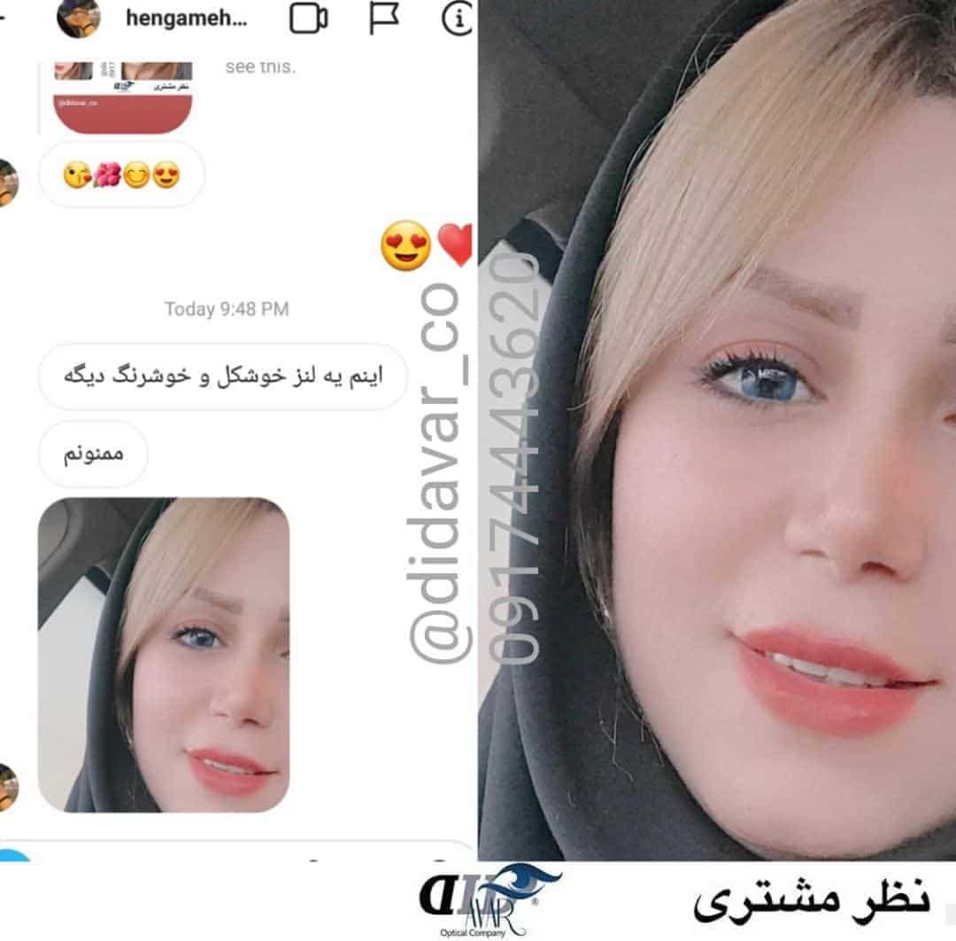 نظر مشتری لنز آبی خاص