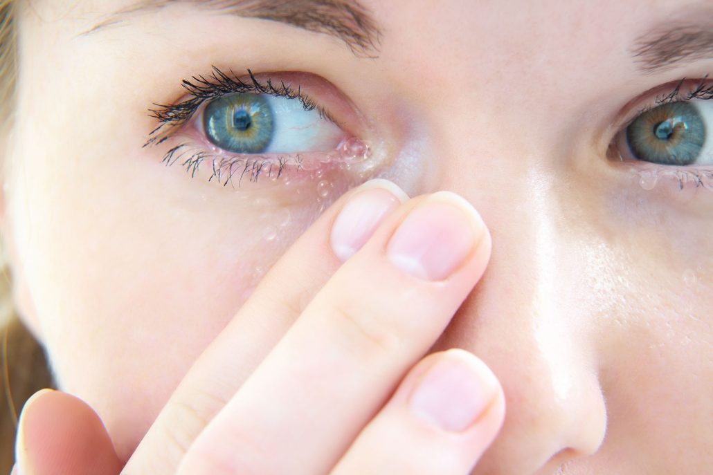 حساسیت به لنز چشم